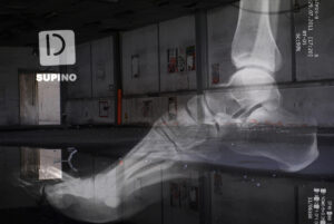 radiografia di piede